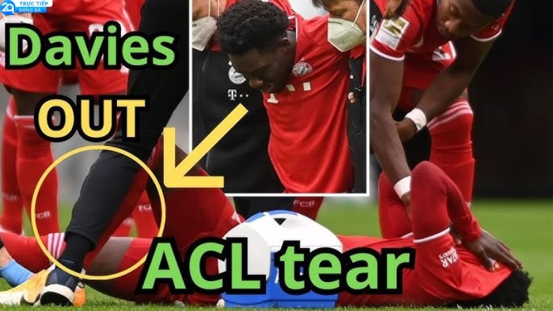 Bi Kịch Cho Canada: Alphonso Davies Đứt Dây Chằng, Mùa Giải Tan Thành Mây Khói! 3 alphonso-davies-2